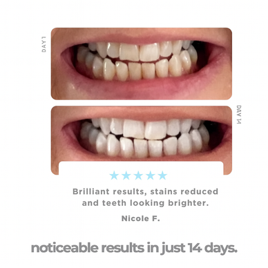Unlock Your Confident, Dazzling Smile Today!